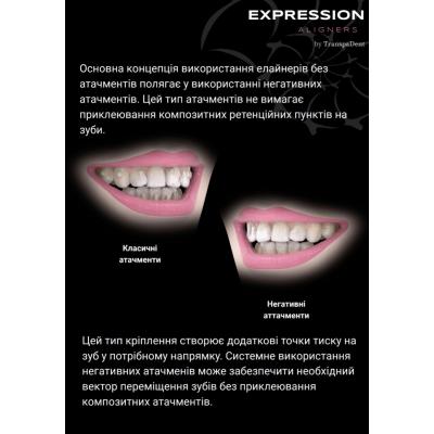 Безатачментова система елайнерів Expression