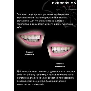 Безатачментова система елайнерів Expression